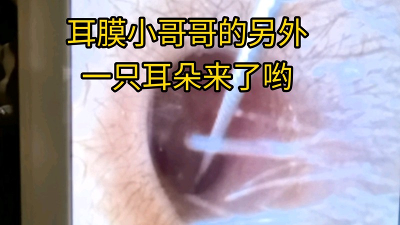 我的耳朵—城市噪音里的一个小小避难所