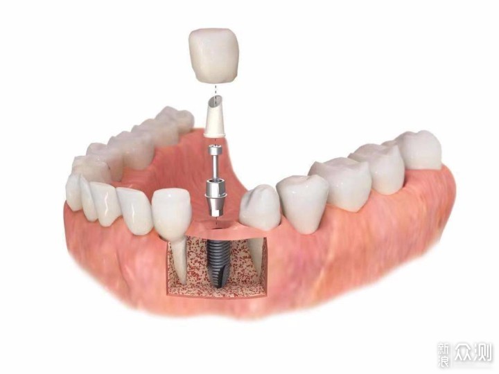 牙疼到想搬家的早晨？