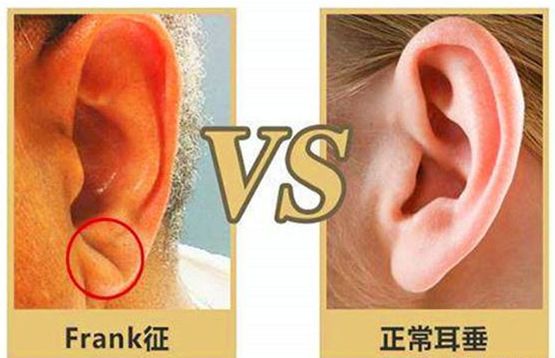 耳垂的秘密—情话中的温柔触碰